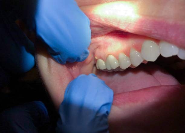 Best Weekend Emergency Dentist in Goodland, IN